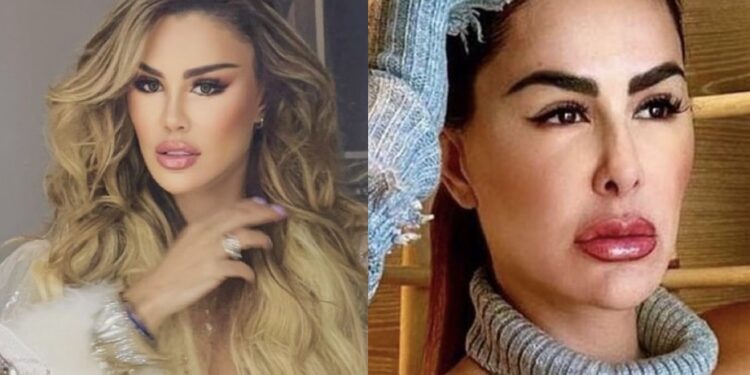 De acuerdo con el programa 'Chisme No Like', Ninel Conde habría viajado a Turquía para retirarse biopolímeros del rostro.