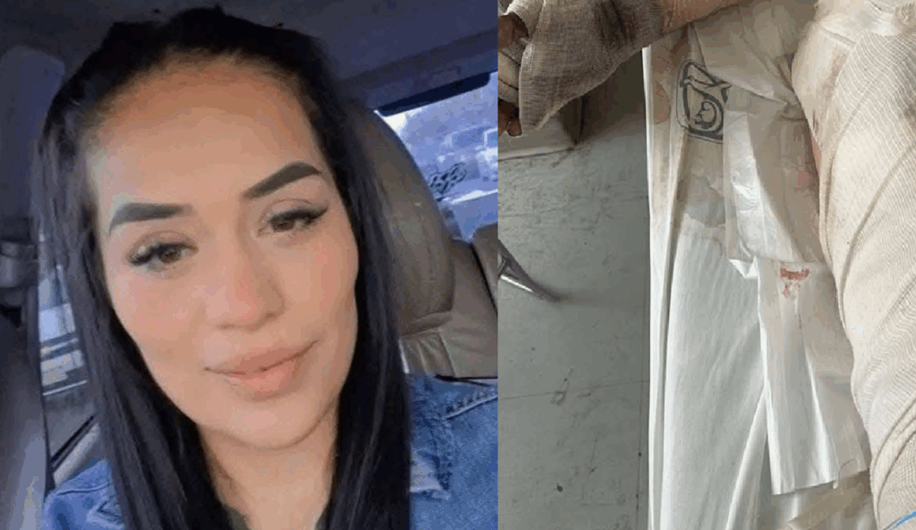 La mujer fue atacada con gasolina y fuego; ha sobrevivido a 12 cirugías y lucha contra graves infecciones