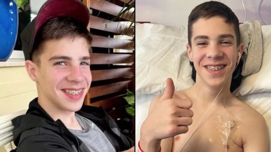 Joven británico vive con una extraña condición que lo obliga a alimentarse por tubos