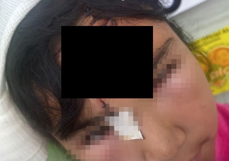 Niña rarámuri es atacada por perro ; dueña se deslinda