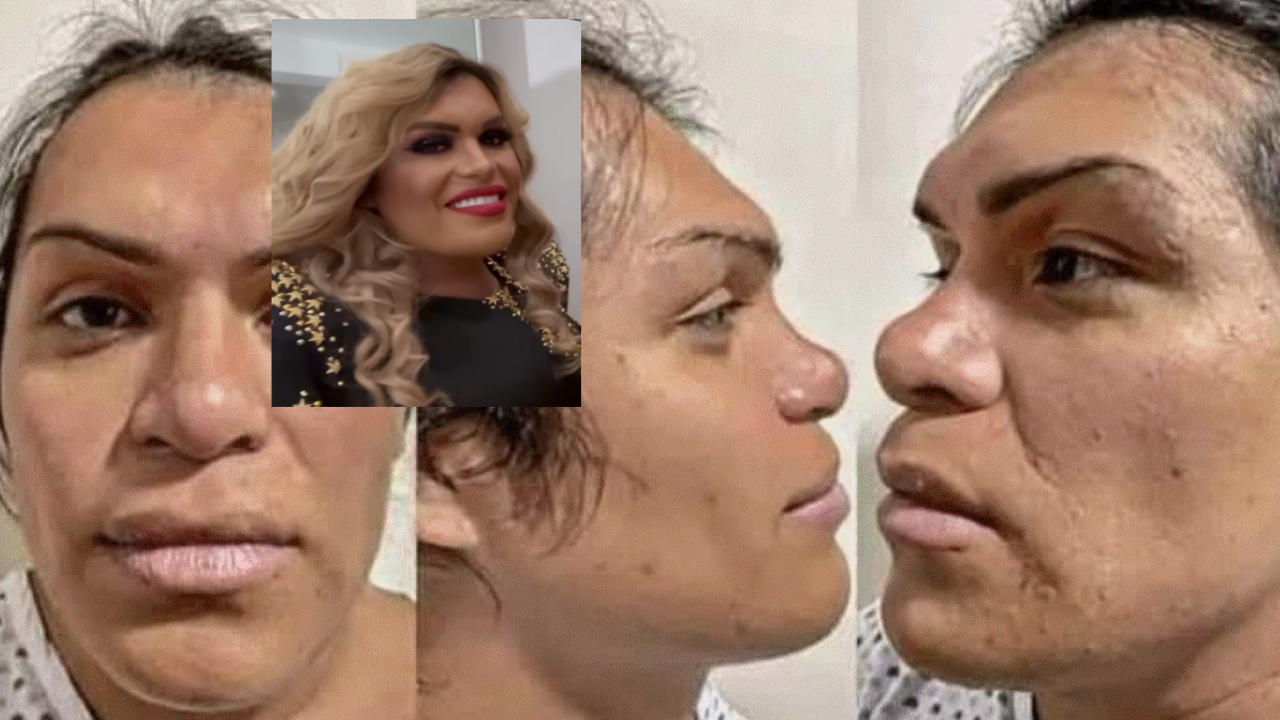 Wendy Guevara revela que se someterá a cirugía de feminización facial en Tailandia