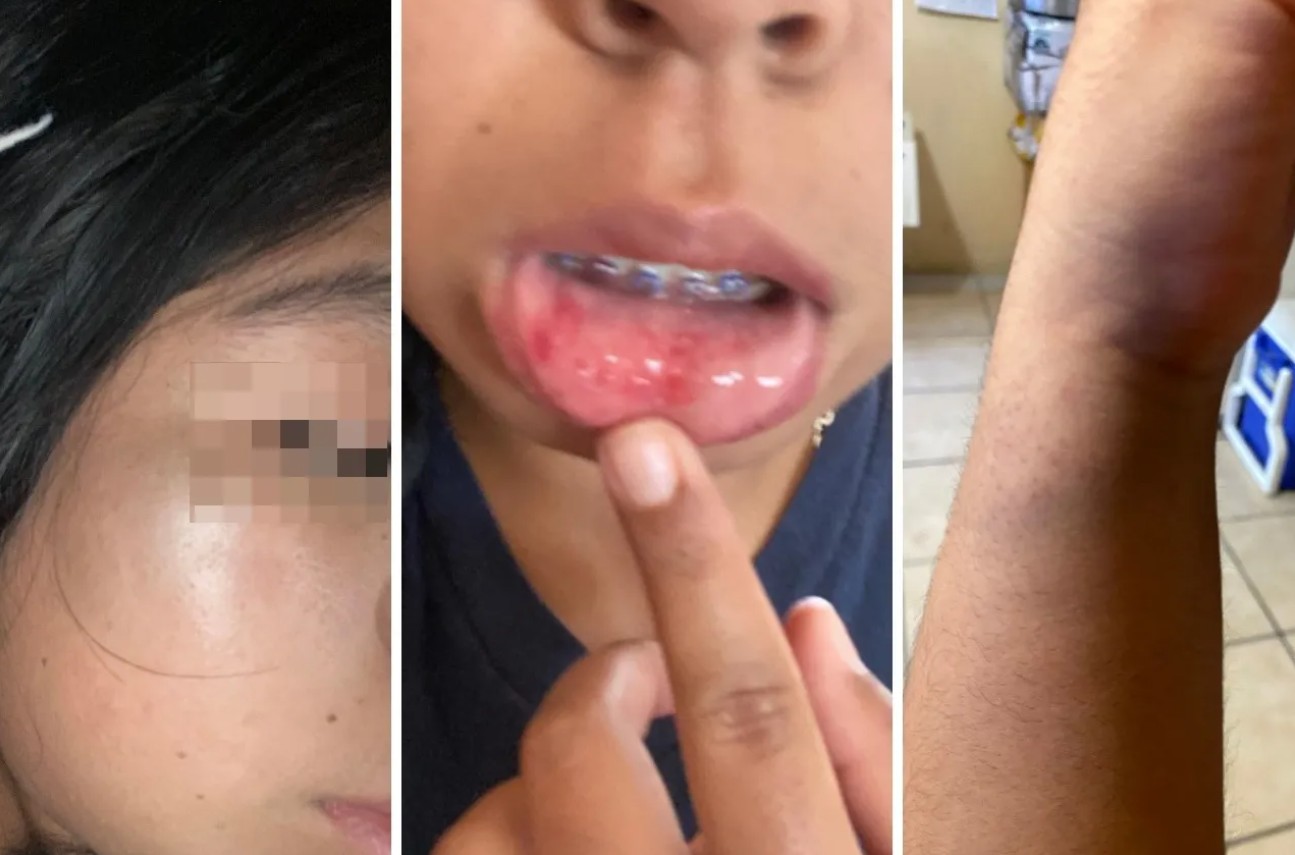 Estudiante denuncia vi0lent0 4s4lto cerca del IIT de la UACJ 1