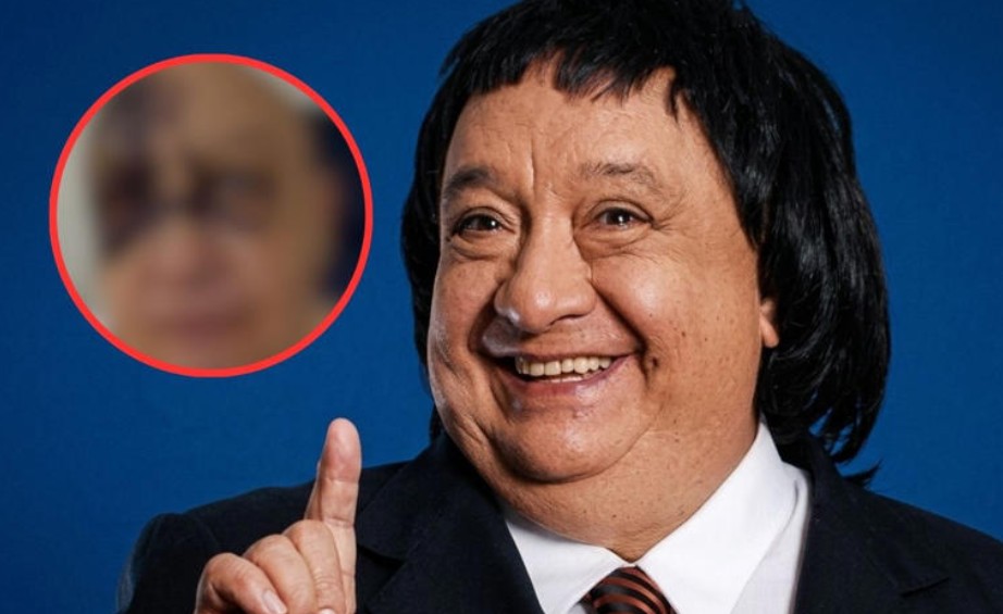 Luis de Alba reaparece tras accidente y preocupa a sus seguidores por su aspecto 1