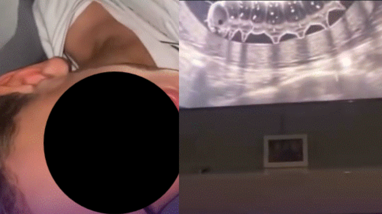 Un video grabado en Brasil muestra al menor angustiado después de que sus padres le hicieron creer que una ecografía revelaba un gusano en su estómago.