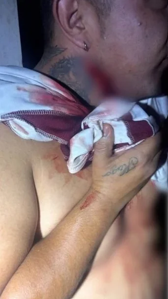 Noche violenta en La Cuesta: riña deja tres hombres her1d0s 3