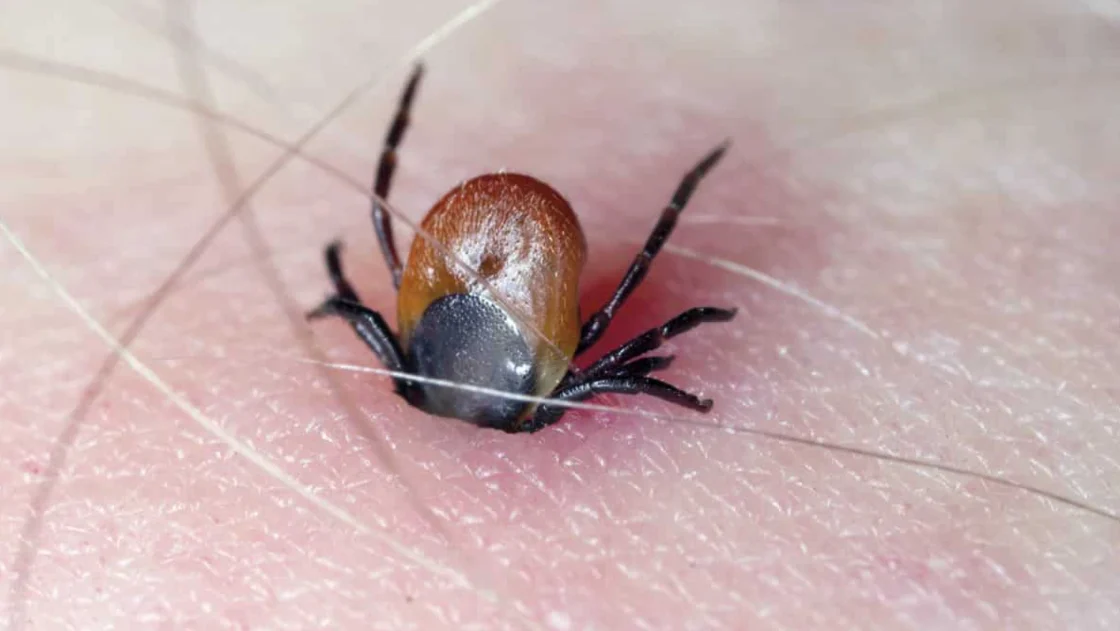 Rickettsia g0lpea a Juárez: 34 vidas perdidas y 74 contagios en ocho meses