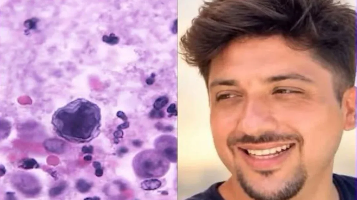 Lago artificial de Mérida cerrado tras detección de Naegleria fowleri