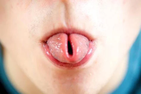 Persona doblando la lengua en forma de taquito o U