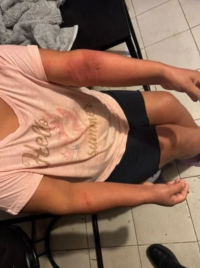 ¡Casi termina en tragedia! Fuga de gas provoca flamazo 2