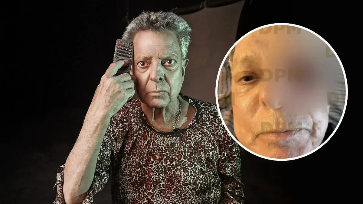 Actor César Bono durante una aparición pública antes de su cirugía